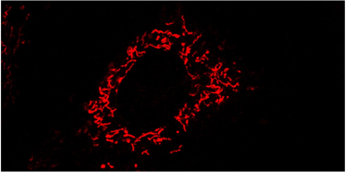 Detection of mitochondrial superoxide anion