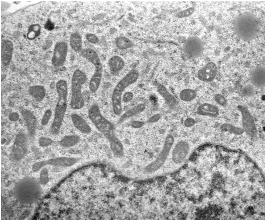 mitocondri microscopia elettronica